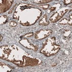 Immunohistochemical staining of human prostate shows moderate to strong cytoplasmic positivity in glandular cells.