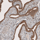 Immunohistochemical staining of human fallopian tube shows moderate to strong cytoplasmic positivity in glandular cells.