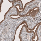 Immunohistochemical staining of human fallopian tube shows moderate to strong cytoplasmic positivity in glandular cells.