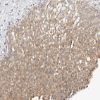 Immunohistochemical staining of human Urinary bladder shows moderate cytoplasmic positivity in urothelial cells.