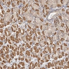 Immunohistochemical staining of human Stomach shows strong cytoplasmic positivity in glandular cells.