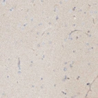 Immunohistochemical staining of human Cerebral cortex shows no positivity in neuronal cells as expected.