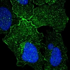 Immunofluorescent staining of human cell line U-2 OS shows localization to plasma membrane.