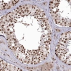 Immunohistochemical staining of human testis shows strong nuclear positivity in cells in seminiferous ducts.
