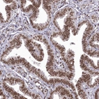 Immunohistochemical staining of human Fallopian tube shows strong nuclear positivity in glandular cells.