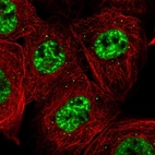 Immunofluorescent staining of human cell line A-431 shows localization to nuclear speckles & cytoplasmic bodies.