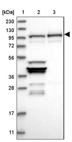 Lane 1: Marker [kDa] 230, 130, 95, 72, 56, 36, 28, 17, 11_br/_Lane 2: Human cell line RT-4_br/_Lane 3: Human cell line U-251 MG