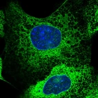 Immunofluorescent staining of human cell line A-431 shows localization to endoplasmic reticulum.