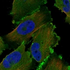 Immunofluorescent staining of human cell line U-251 MG shows localization to plasma membrane & cytosol.