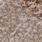 Anti-PIP4K2C Antibody