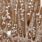 Anti-PRRC2C Antibody
