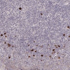 Anti-HCAR2 Antibody