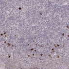 Anti-HCAR2 Antibody