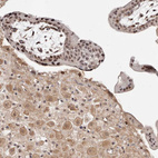 Immunohistochemical staining of human placenta shows strong nuclear positivity in trophoblastic cells.