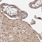 Immunohistochemical staining of human placenta shows strong nuclear positivity in trophoblastic cells.