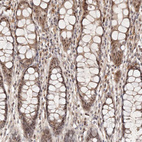 Immunohistochemical staining of human rectum shows strong nuclear positivity in glandular cells.