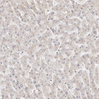 Immunohistochemical staining of human liver shows no positivity in hepatocytes as expected.