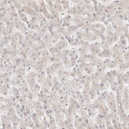 Immunohistochemical staining of human liver shows no positivity in hepatocytes as expected.