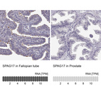 Anti-SPAG17 Antibody