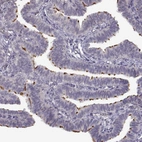 Immunohistochemical staining of human Fallopian tube shows strong cytoplasmic positivity in ciliated cells.