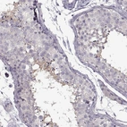 Immunohistochemical staining of human testis shows moderate cytoplasmic positivity in spermatids in seminiferous ducts.