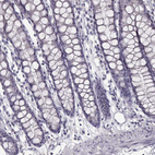 Anti-SPAG17 Antibody