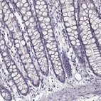 Immunohistochemical staining of human colon shows no positivity in glandular cells as expected.