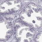 Anti-SPAG17 Antibody