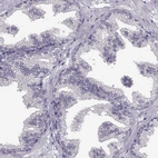 Immunohistochemical staining of human prostate shows no positivity in glandular cells as expected.