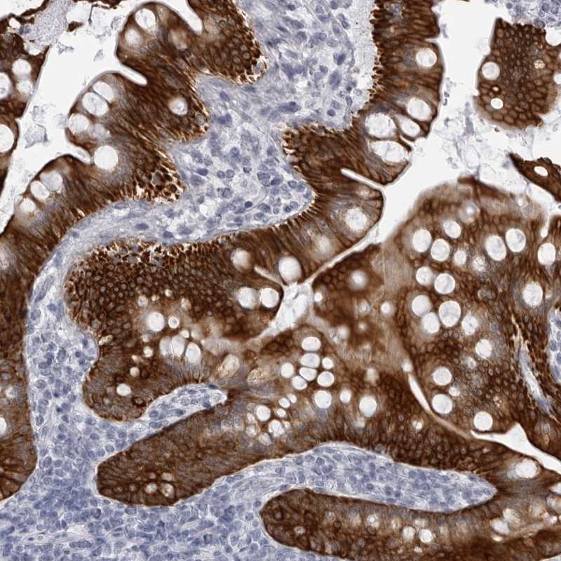 Anti-UROD Antibody