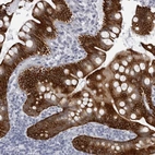 Anti-UROD Antibody