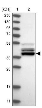 Lane 1: Marker [kDa] 230, 130, 95, 72, 56, 36, 28, 17, 11_br/_Lane 2: Human cell line RT-4