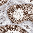 Immunohistochemical staining of human testis shows strong nuclear positivity in cells in seminiferous ducts.