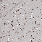 Immunohistochemical staining of human cerebral cortex shows strong nuclear positivity in neurons.