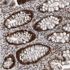 Immunohistochemical staining of human colon shows strong nuclear positivity in glandular cells.