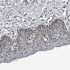 Immunohistochemical staining of human skin shows strong nuclear positivity in squamous epithelial cells.