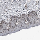 Immunohistochemical staining of human skin shows strong nuclear positivity in squamous epithelial cells.