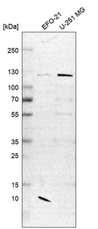 Western blot analysis in human cell line EFO-21 and human cell line U-251 MG.