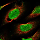 Immunofluorescent staining of human cell line U-2 OS shows localization to nucleoplasm.