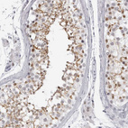 Immunohistochemical staining of human testis shows moderate membranous positivity in cells in seminiferous ducts.