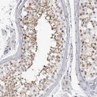Immunohistochemical staining of human testis shows moderate membranous positivity in cells in seminiferous ducts.