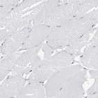 Immunohistochemical staining of human skeletal muscle shows no positivity in myocytes as expected.