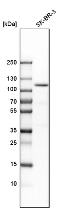 Western blot analysis in human cell line SK-BR-3.