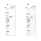Western blot analysis using Anti-HSPH1 antibody HPA028675 (A) shows similar pattern to independent antibody HPA031569 (B).