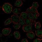 Anti-AHDC1 Antibody