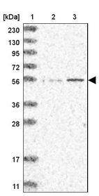 Lane 1: Marker [kDa] 230, 130, 95, 72, 56, 36, 28, 17, 11_br/_Lane 2: Human cell line RT-4_br/_Lane 3: Human cell line U-251MG sp