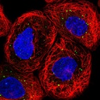Immunofluorescent staining of human cell line A-431 shows localization to vesicles.