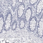 Immunohistochemical staining of human colon shows low expression as expected.