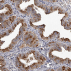 Anti-MTF1 Antibody