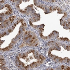 Immunohistochemical staining of human fallopian tube shows strong cytoplasmic positivity in glandular cells.